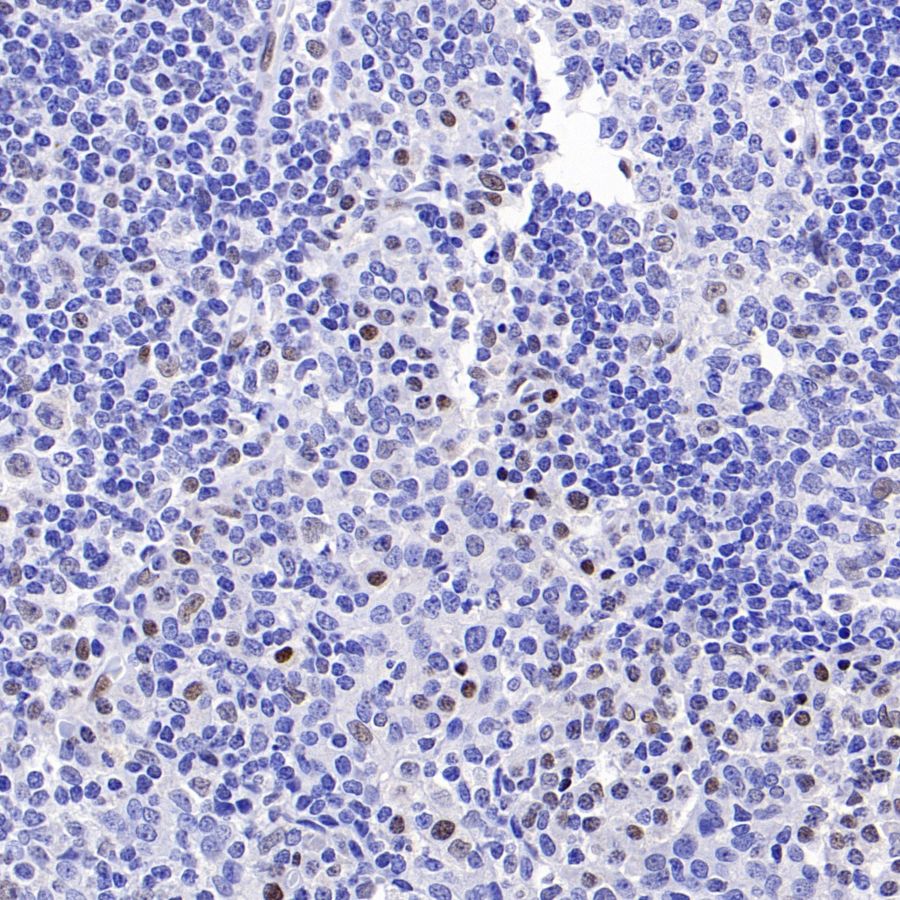 SLFN11 Recombinant Mouse mAb (S-1565-283)