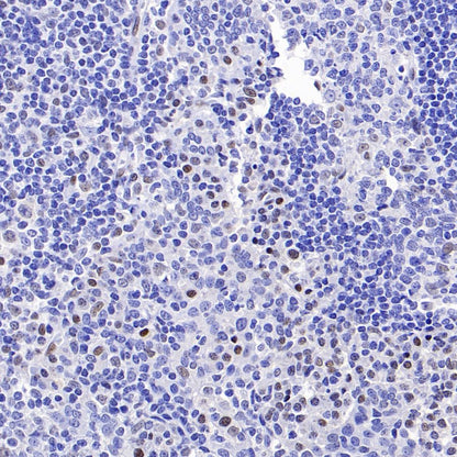 SLFN11 Recombinant Mouse mAb (S-1565-283)
