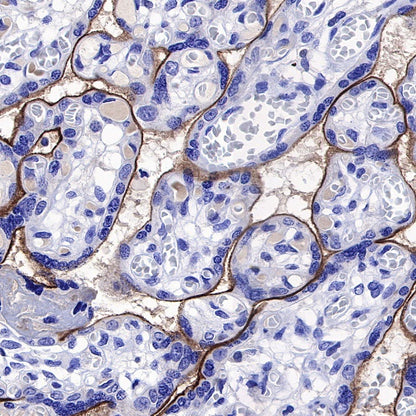 5T4 Recombinant Rabbit mAb (S-R361)