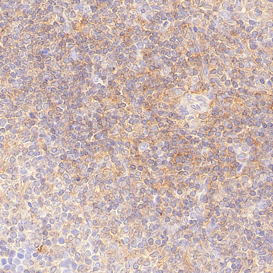 CDC42 Recombinant Rabbit mAb (S-6126)
