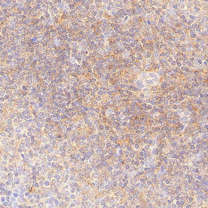 CDC42 Recombinant Rabbit mAb (S-6126)