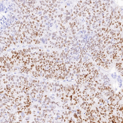 Estrogen Receptor α Recombinant Rabbit mAb (SDT-10001)
