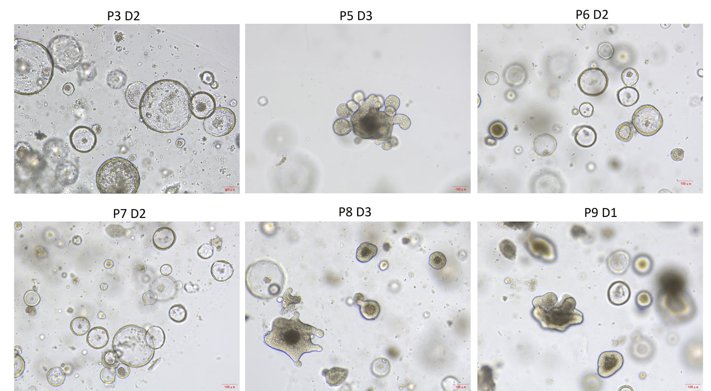 Wnt Surrogate Protein, Human