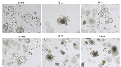 Wnt Surrogate Protein, Human