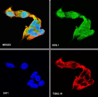 UCHL1 Recombinant Rabbit mAb (S-1765-38)