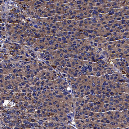 ALDH2 Recombinant Rabbit mAb (S-4173-20)