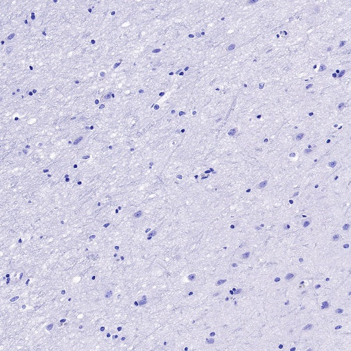 FGL1 Recombinant Rabbit mAb (S-1409-109)