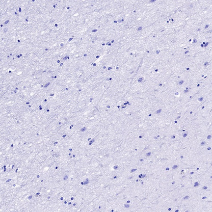 FGL1 Recombinant Rabbit mAb (S-1409-109)