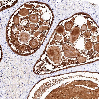 KLK2 Recombinant Rabbit mAb,PBS Only (SDT-4461-80)