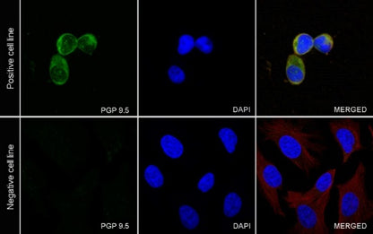 PGP9.5 Recombinant Rabbit mAb (SDT-665-37)