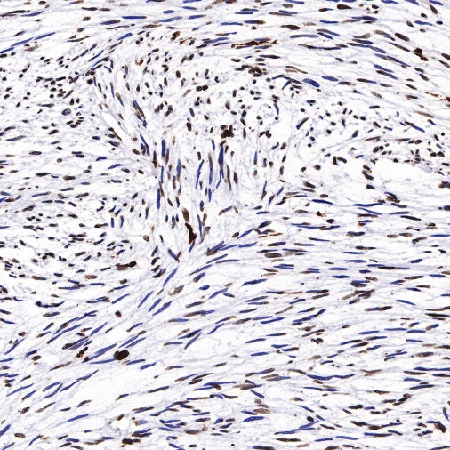 Histone H3 (tri methyl K27) Recombinant Rabbit mAb (SDT-431-118)