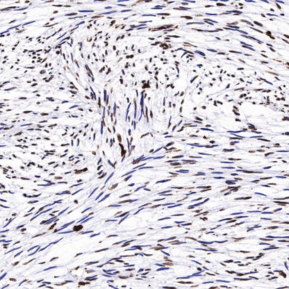 Histone H3 (tri methyl K27) Recombinant Rabbit mAb (SDT-431-118)