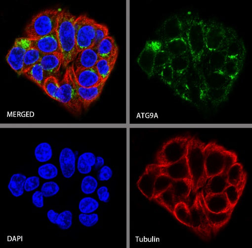 ATG9A Recombinant Rabbit mAb (S-1418-5)
