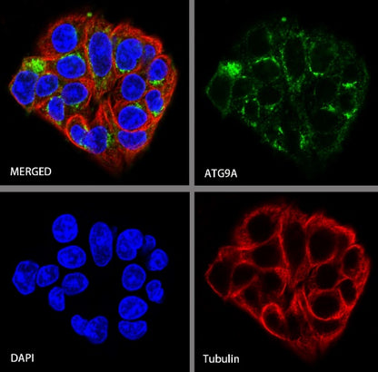 ATG9A Recombinant Rabbit mAb (S-1418-5)