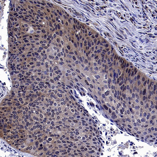 mTOR Recombinant Rabbit mAb (S-698-228)