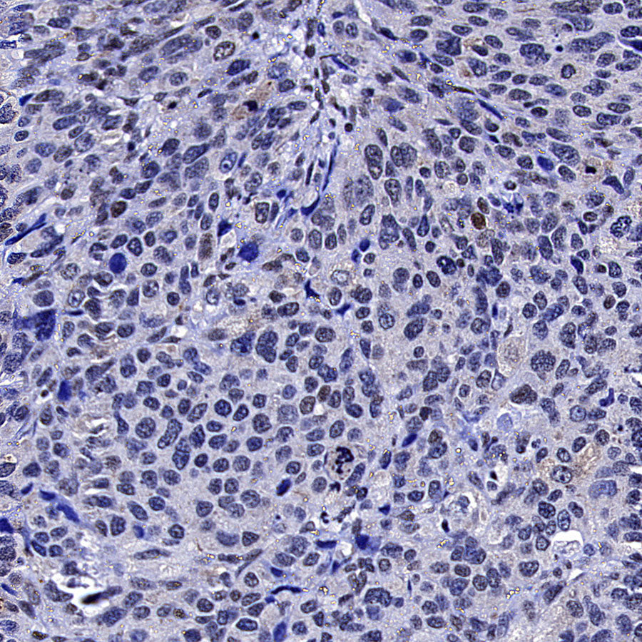 TOP2B Recombinant Rabbit mAb (S-4452-44)