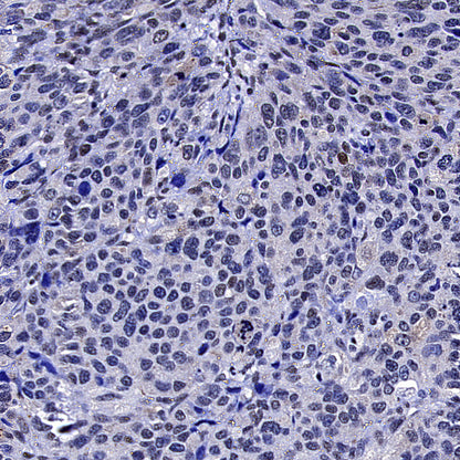 TOP2B Recombinant Rabbit mAb (S-4452-44)