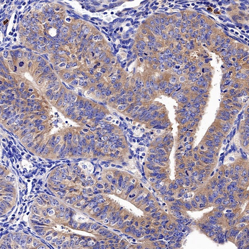 VPS35 Recombinant Rabbit mAb (S-997-2)