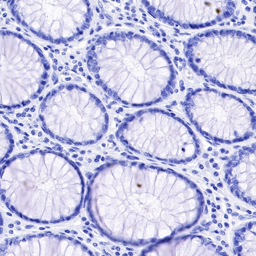 Myelin Basic Protein Recombinant Rabbit mAb (S-582-79)