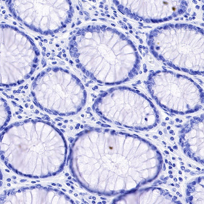 Myelin Basic Protein Recombinant Rabbit mAb (S-582-79)