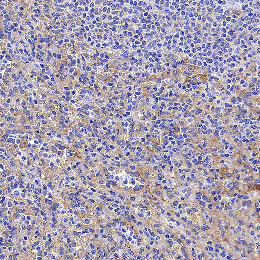 IFIT1 Recombinant Rabbit mAb (S-5120)