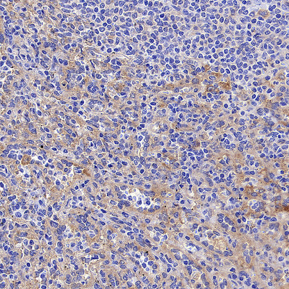 IFIT1 Recombinant Rabbit mAb (S-5120)