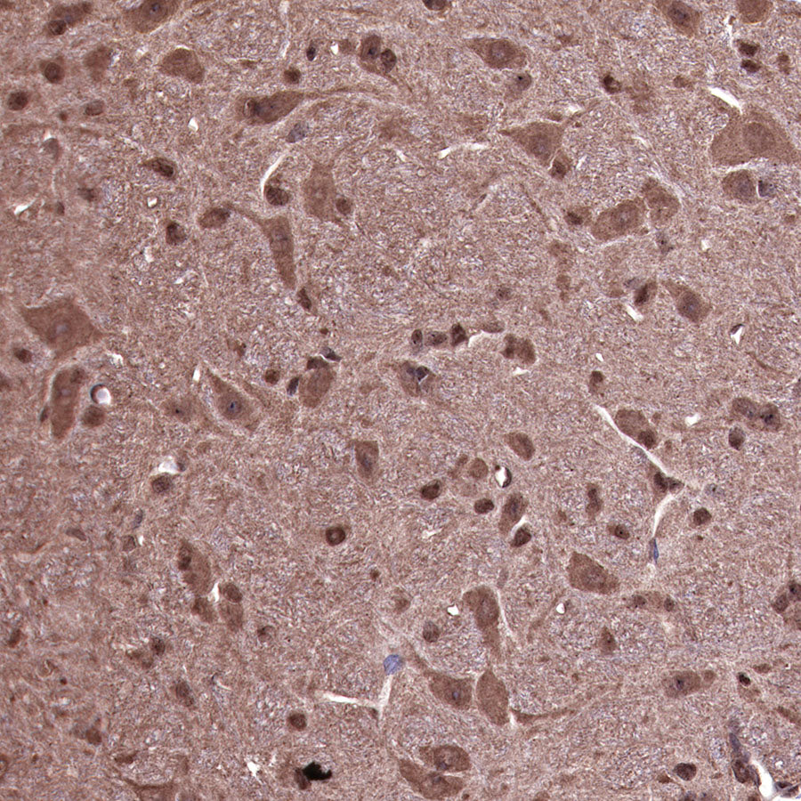 Ubiquitin Rabbit mAb (SDT-R095)