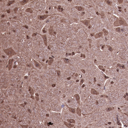 Ubiquitin Rabbit mAb (SDT-R095)