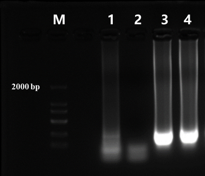 Bst DNA Polymerase, Large fragment