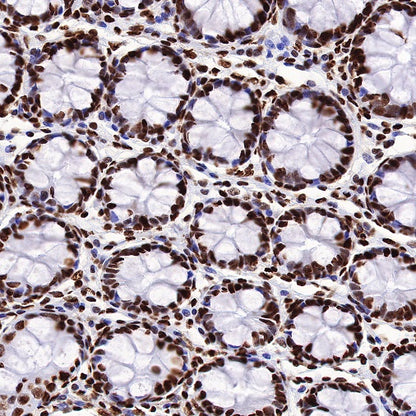 ILF3 Recombinant Rabbit mAb (S-R342)