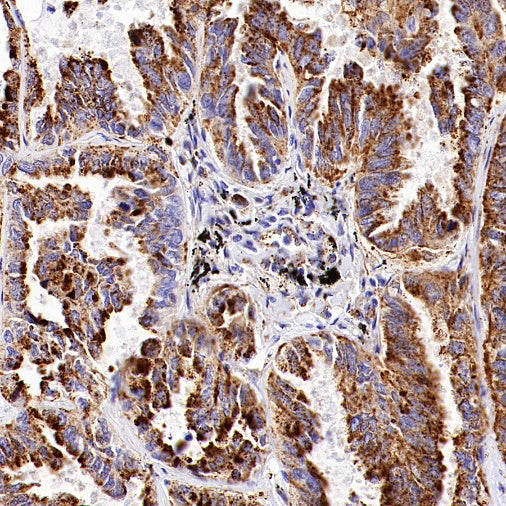GBA Recombinant Rabbit mAb (S-3211-14)