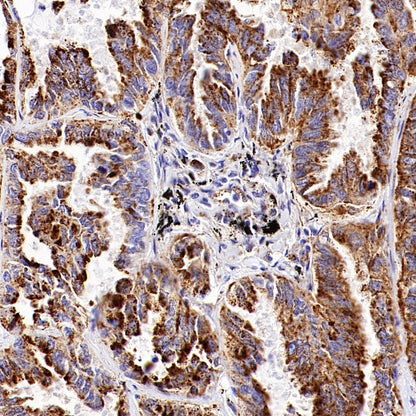 GBA Recombinant Rabbit mAb (S-3211-14)