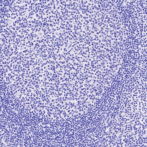 Dystrophin Recombinant Rabbit mAb (S-090-327)