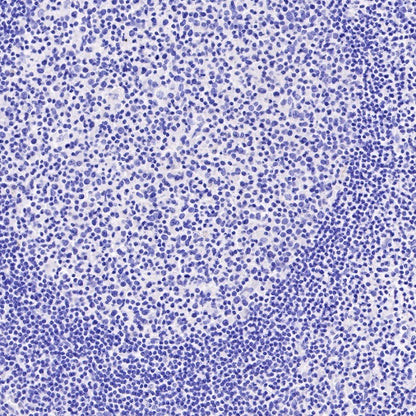 Dystrophin Recombinant Rabbit mAb (S-090-327)