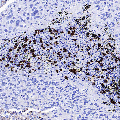 HEG1 Recombinant Rabbit mAb (S-4419-64)