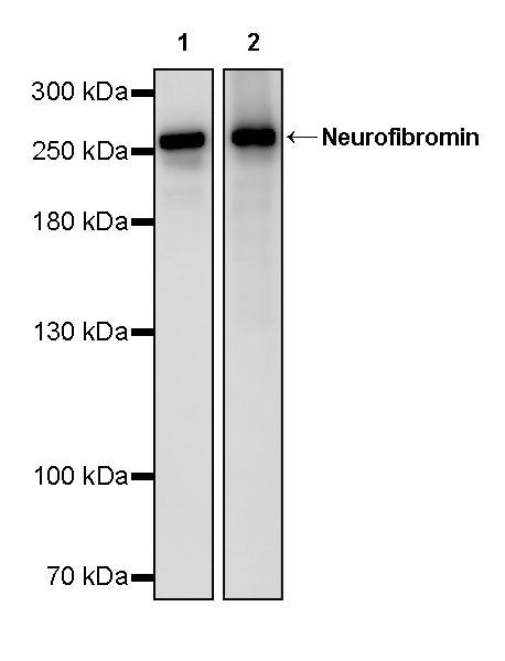 Neurofibromin Recombinant Rabbit mAb (S-3540-15)
