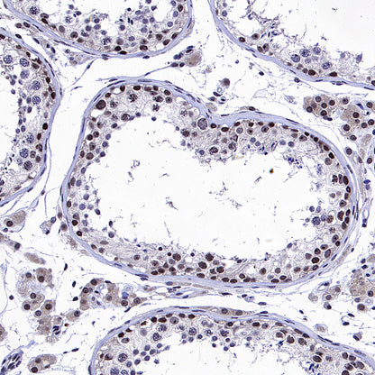 CDK4 Rabbit Polyclonal Antibody