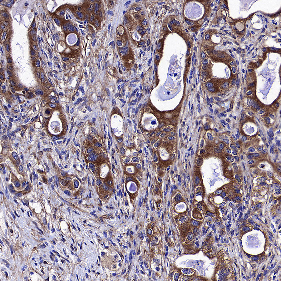Vinculin Recombinant Rabbit mAb (S-5405)