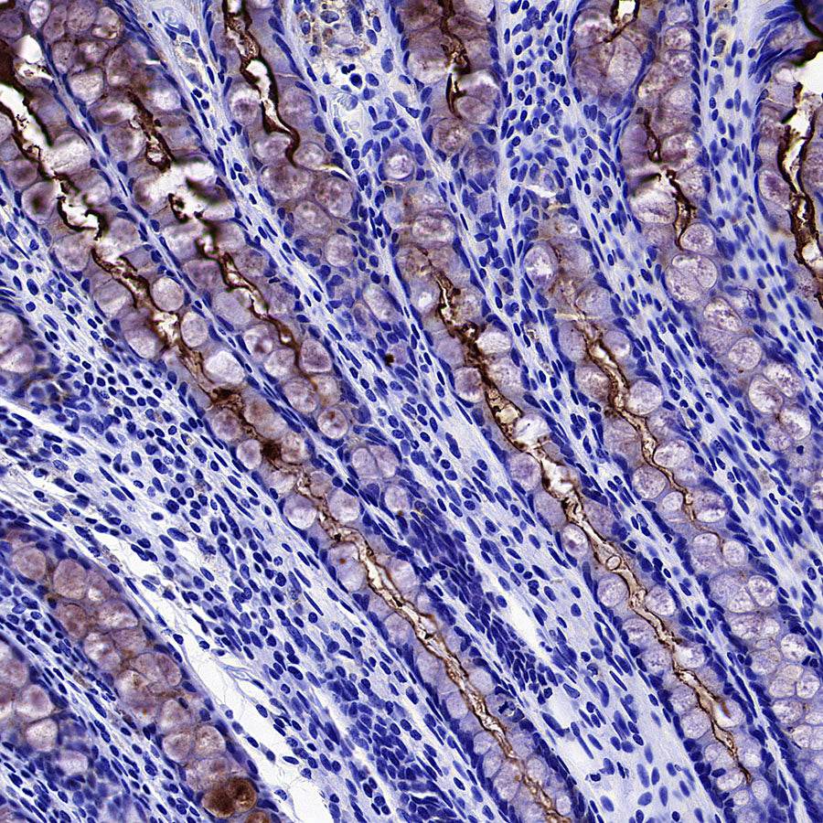 CEA Recombinant Rabbit mAb (SDT-098-63)