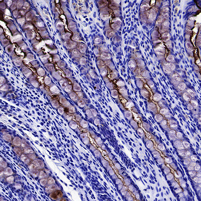 CEA Recombinant Rabbit mAb (SDT-098-63)