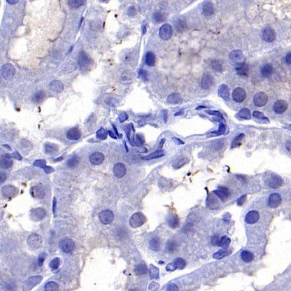 ARL13B Recombinant Rabbit mAb (S-2113-11)