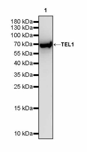 TEL1 Recombinant Rabbit mAb (S-3067-60)