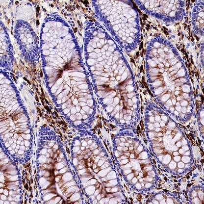 Human IgA1 Recombinant Rabbit mAb (S-2513-50)