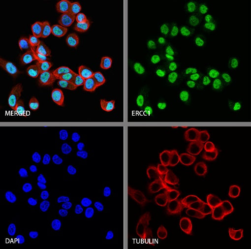 ERCC1 Recombinant Rabbit mAb (SDT-2458-29)