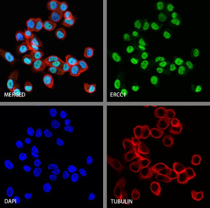 ERCC1 Recombinant Rabbit mAb (SDT-2458-29)