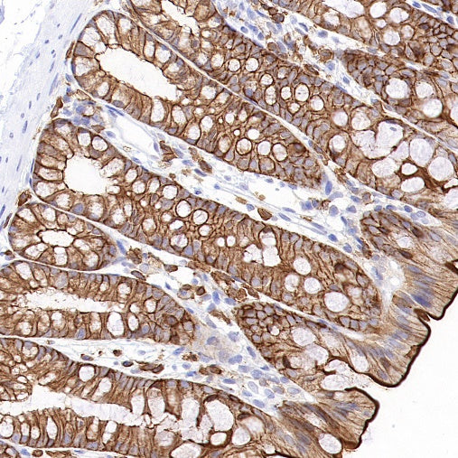 Ezrin Recombinant Rabbit mAb (S-1894-4)