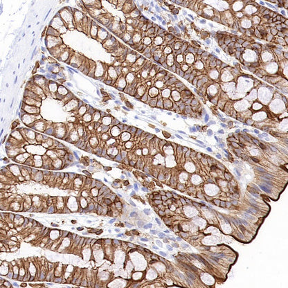 Ezrin Recombinant Rabbit mAb (S-1894-4)