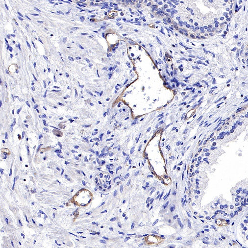 VEGF Receptor 2/FLK-1 Recombinant Rabbit mAb (S-R400)