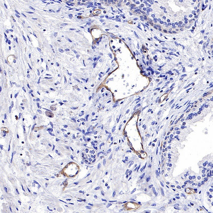 VEGF Receptor 2/FLK-1 Recombinant Rabbit mAb (S-R400)