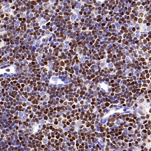 TOX Recombinant Rabbit mAb (S-2296-44)